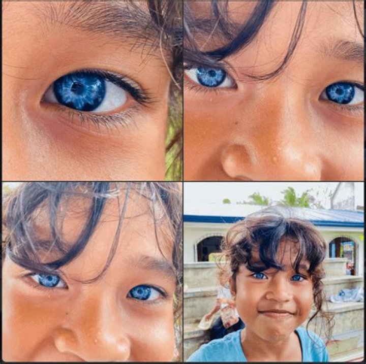 Are blue eyes a mutation?