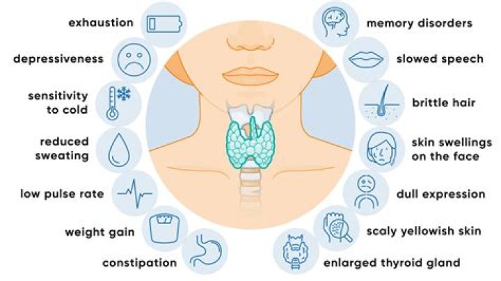 Are dry eyes a symptom of underactive thyroid?