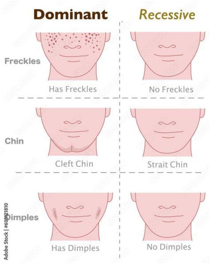 Are freckles recessive or dominant?