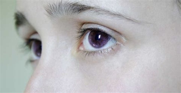 Are purple eyes possible?