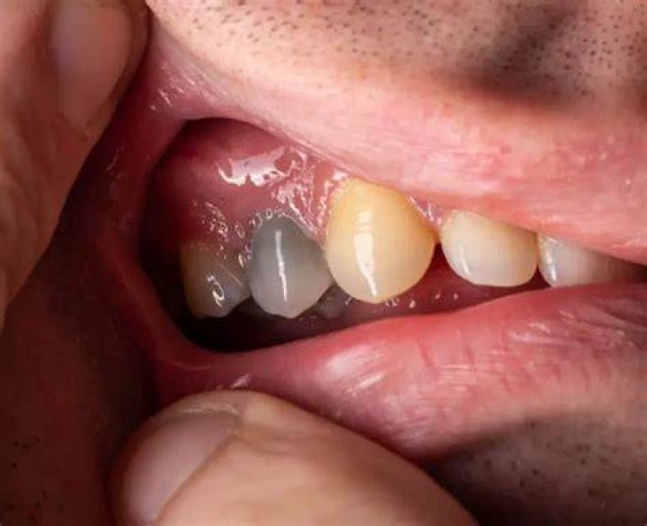 Are teeth dead or alive?