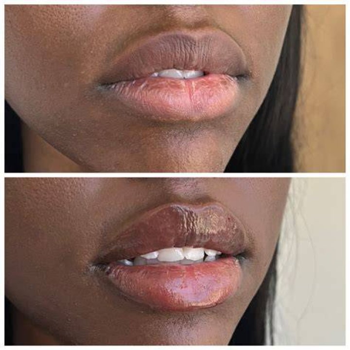 Are the lips sensitive?