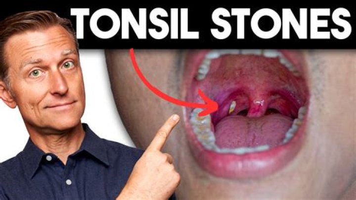 Are tonsils useless?