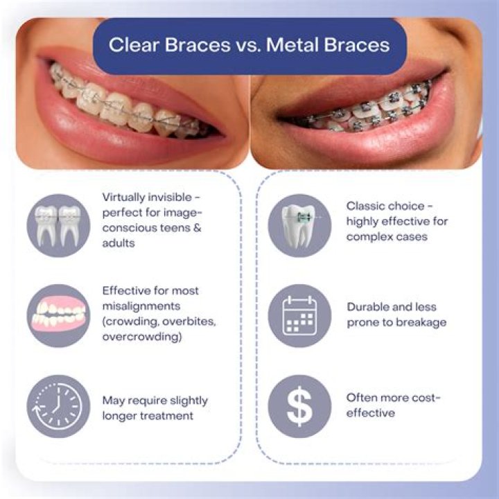 Are transparent braces good?