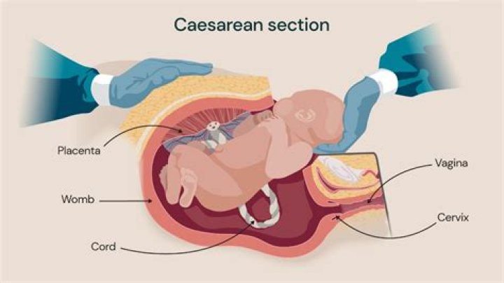 Are you awake during ac section?