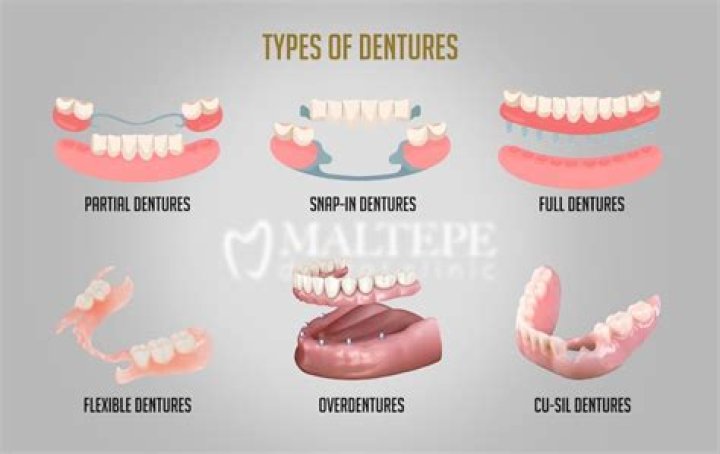 At what point do you need dentures?