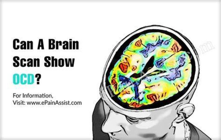 Can a brain scan show OCD?
