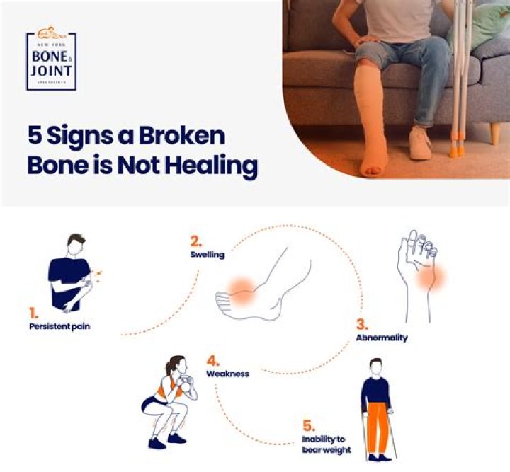 Can a broken bone hurt years later?
