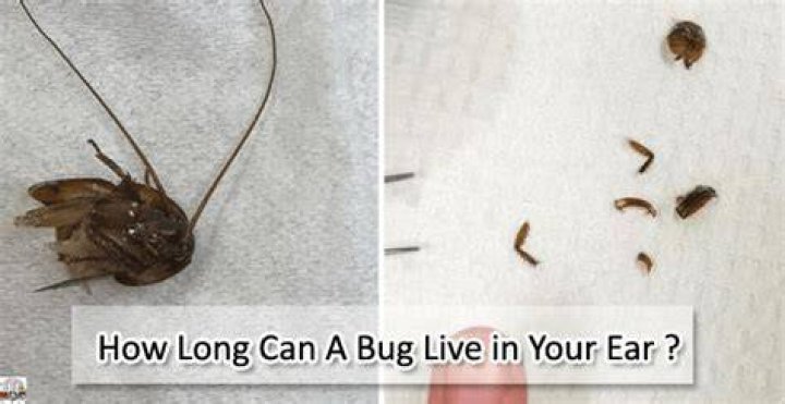 Can a bug live in your ear?