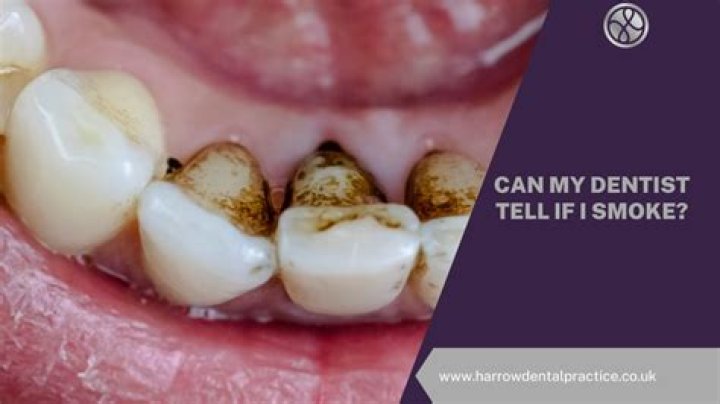 Can a dentist tell if you have nerve damage?