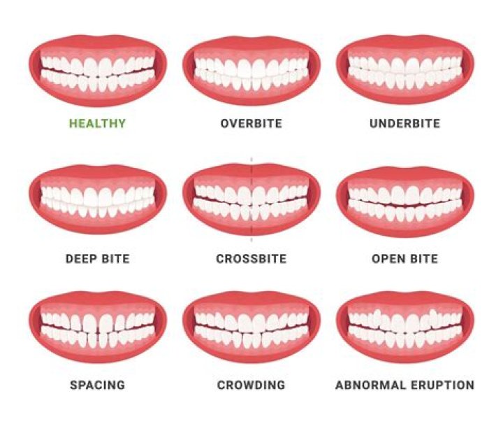 Can a dentist tell if your bite is off?