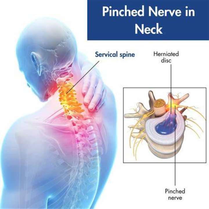 Can a pinched nerve in your neck cause ear ringing?