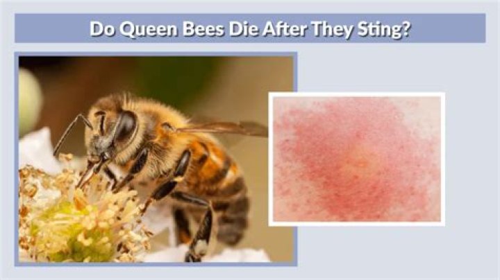 Can a queen bee sting?