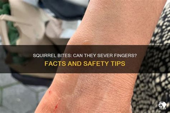 Can a squirrel bite your finger off?