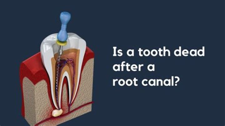 Can a tooth root grow back?