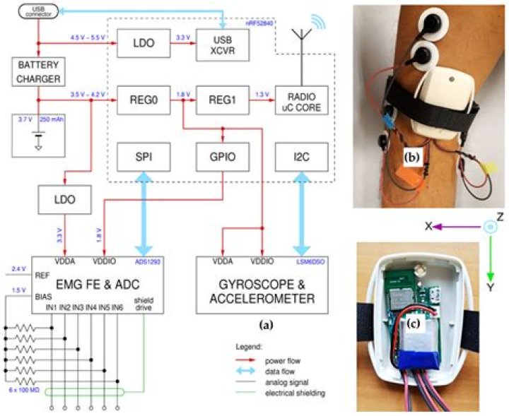 Can an EMG rule out MS?