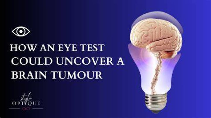 Can an eye test detect a brain tumour?