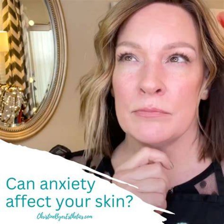 Can anxiety affect your skin?