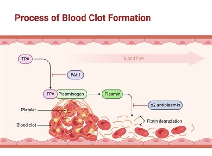 Can blood clot go away on its own?