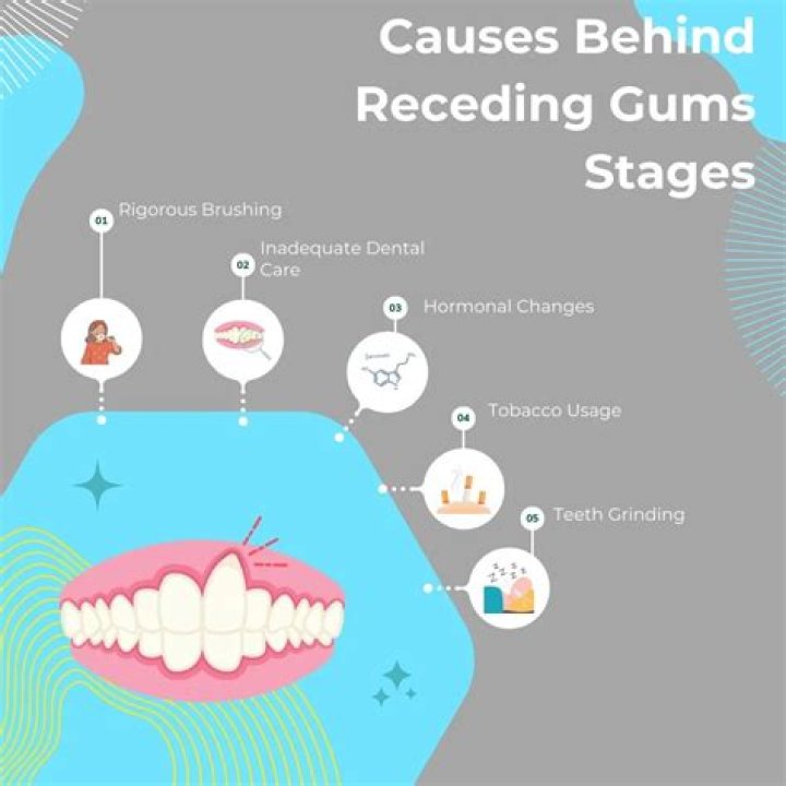 Can braces cause receding gums?