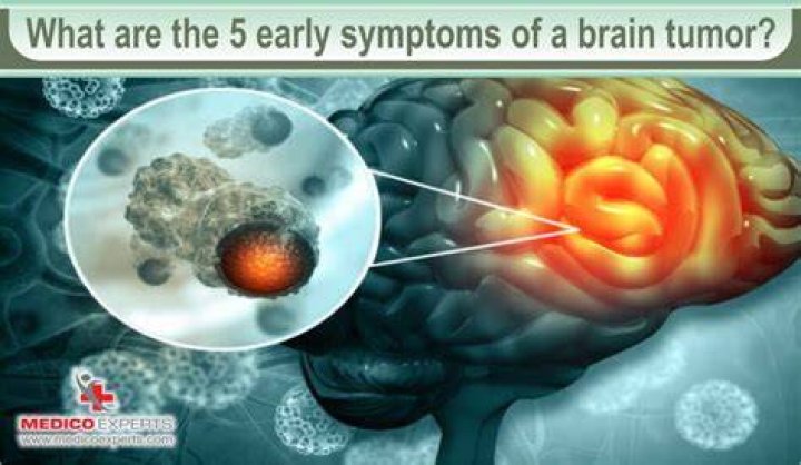 Can brain tumor be cured completely?