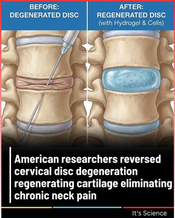 Can cartilage be regenerated?