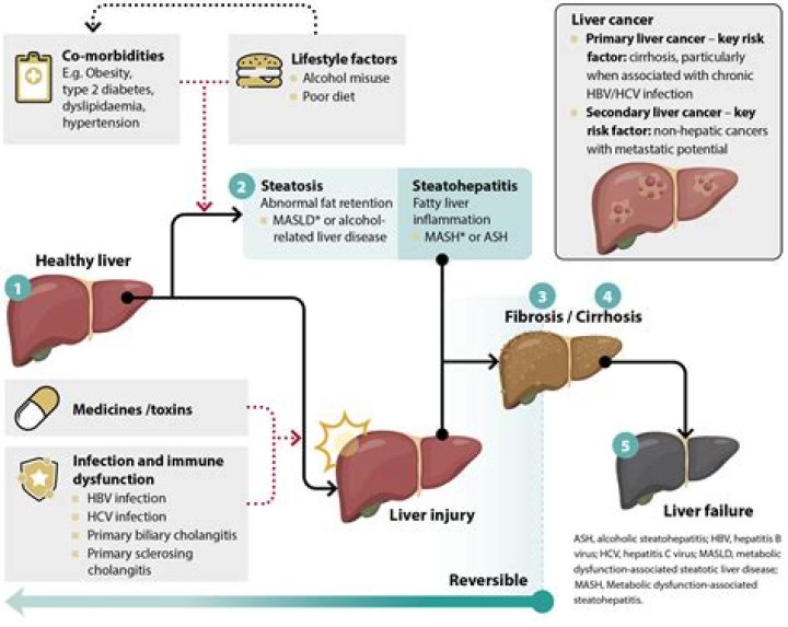 Can Covid affect liver enzymes?