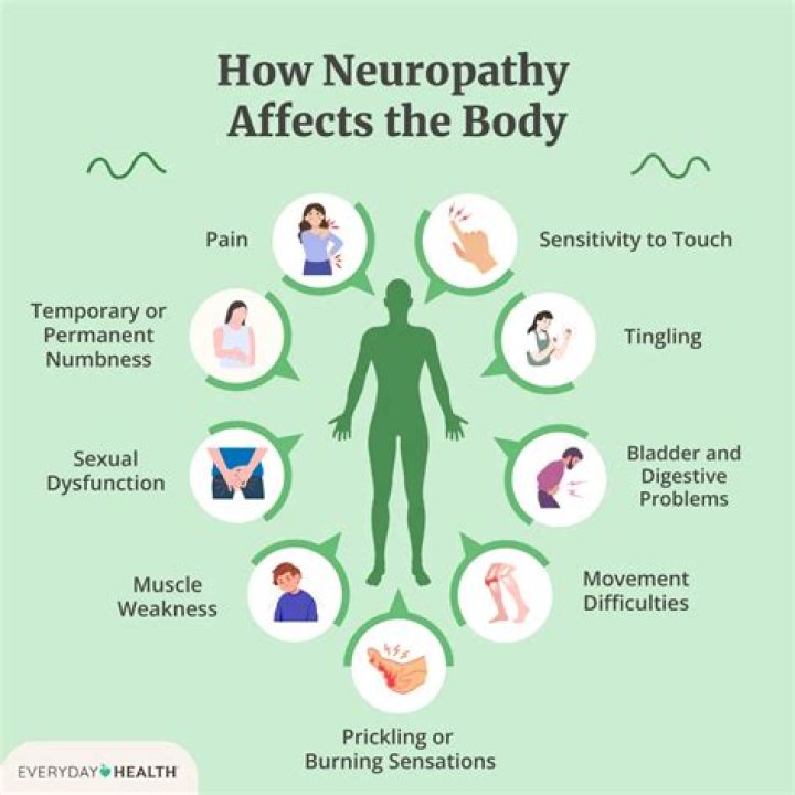 Can Covid make neuropathy worse?
