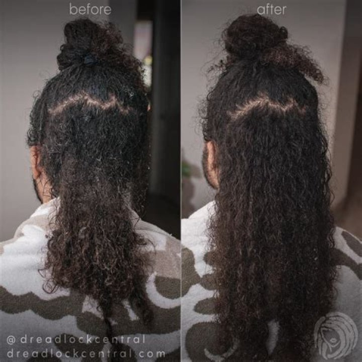 Can dreadlocks be undone?