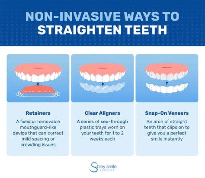 Can fake braces straighten your teeth?