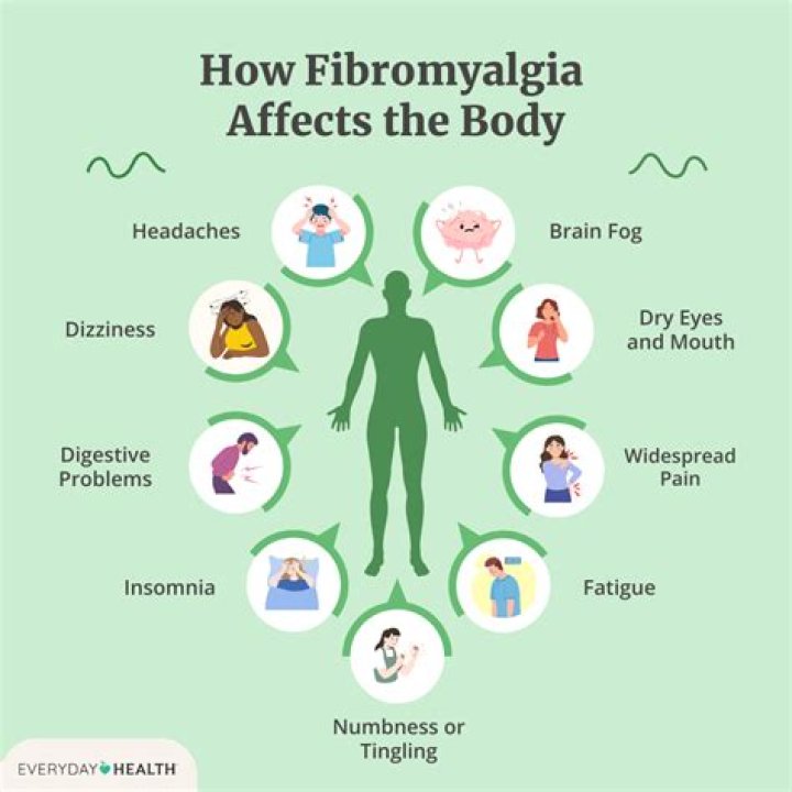 Can fibromyalgia be triggered by COVID?