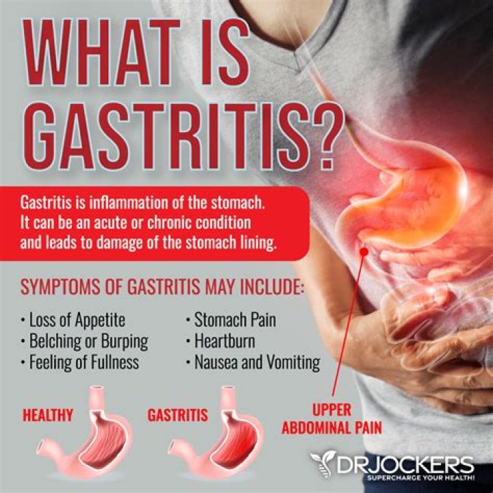 Can gastritis cause fatigue and dizziness?