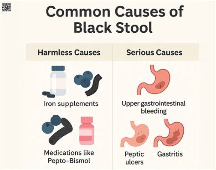 Can hemorrhoids cause black stool?