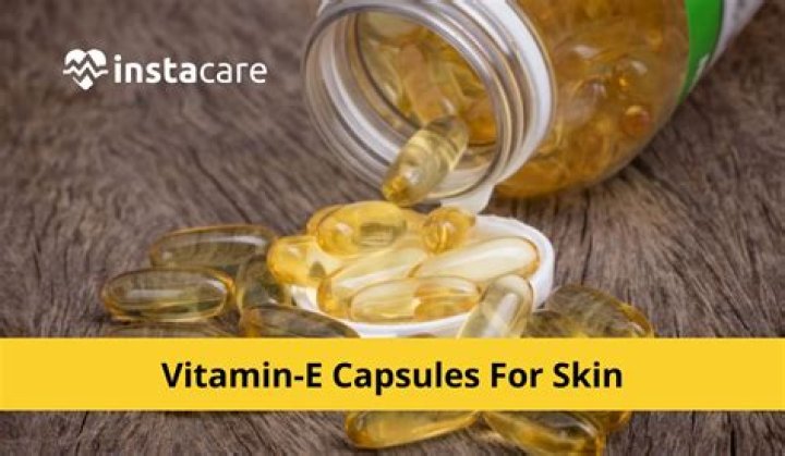 Can I apply vitamin E capsule directly on my skin?