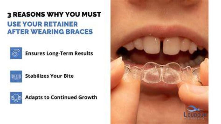 Can I eat with retainers on?