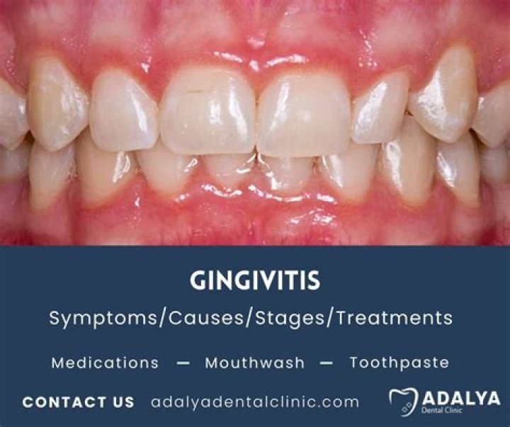 Can I reverse gingivitis on my own?