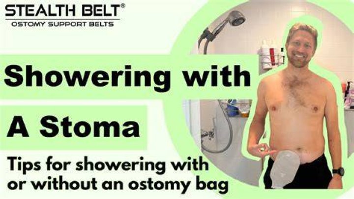 Can I wash my stoma in the shower?