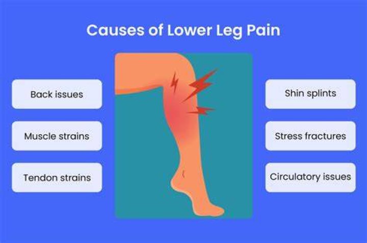 Can lying in bed too much cause leg pain?