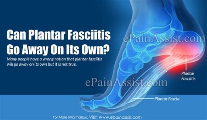 Can plantar fasciitis go away on its own?