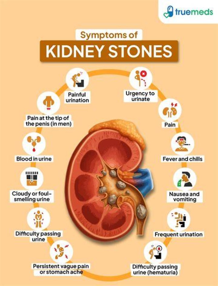 Can taking turmeric cause kidney stones?