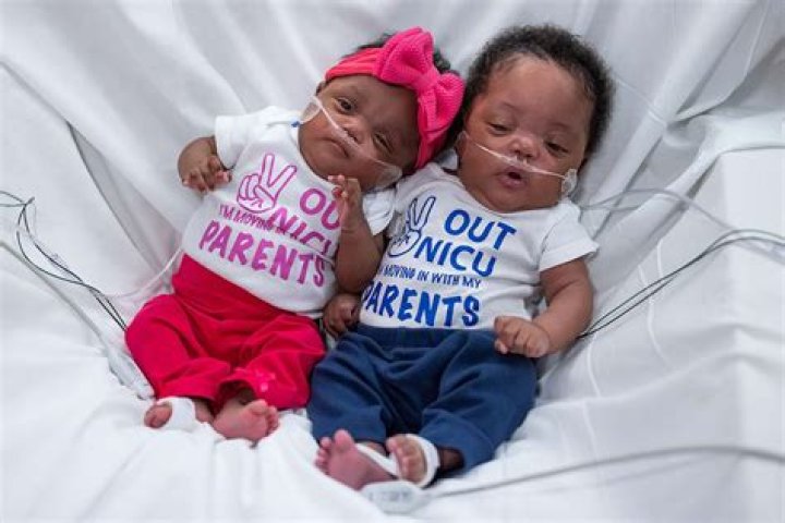 Can twins be born 1 minute apart?