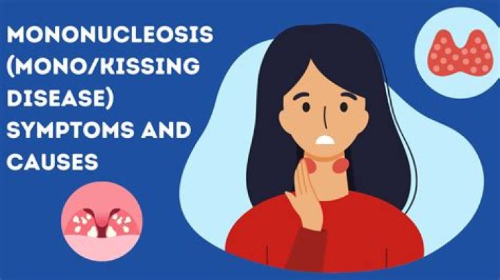 Can two people with mono kiss?
