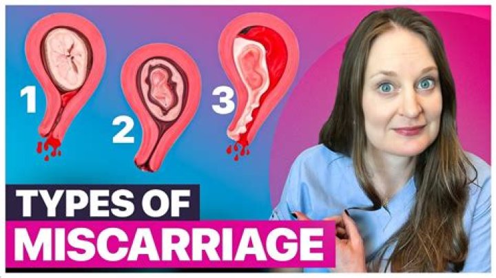 Can ultrasounds cause miscarriages?