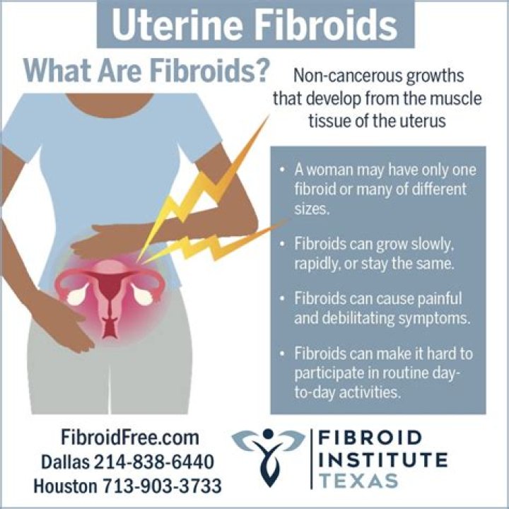Can you feel fibroids moving in your stomach?