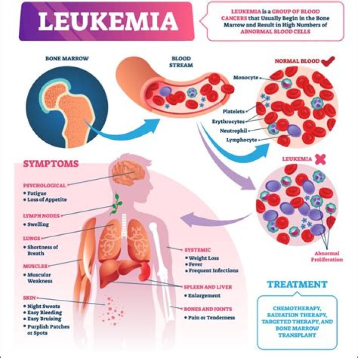 Can you get leukemia from breast implants?