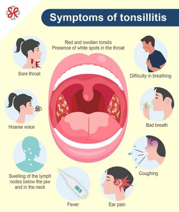 Can you get tonsillitis from not brushing your teeth?