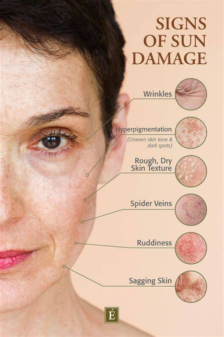 Can you go in the sun while taking methotrexate?
