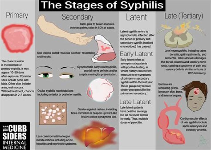 Can you have syphilis for 20 years and not know it?