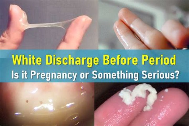 Can you have thick white discharge when pregnant?