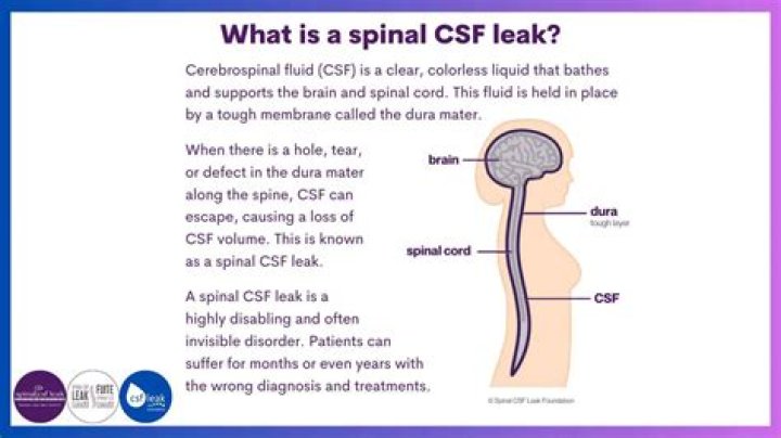 Can you hear your own spinal fluid?